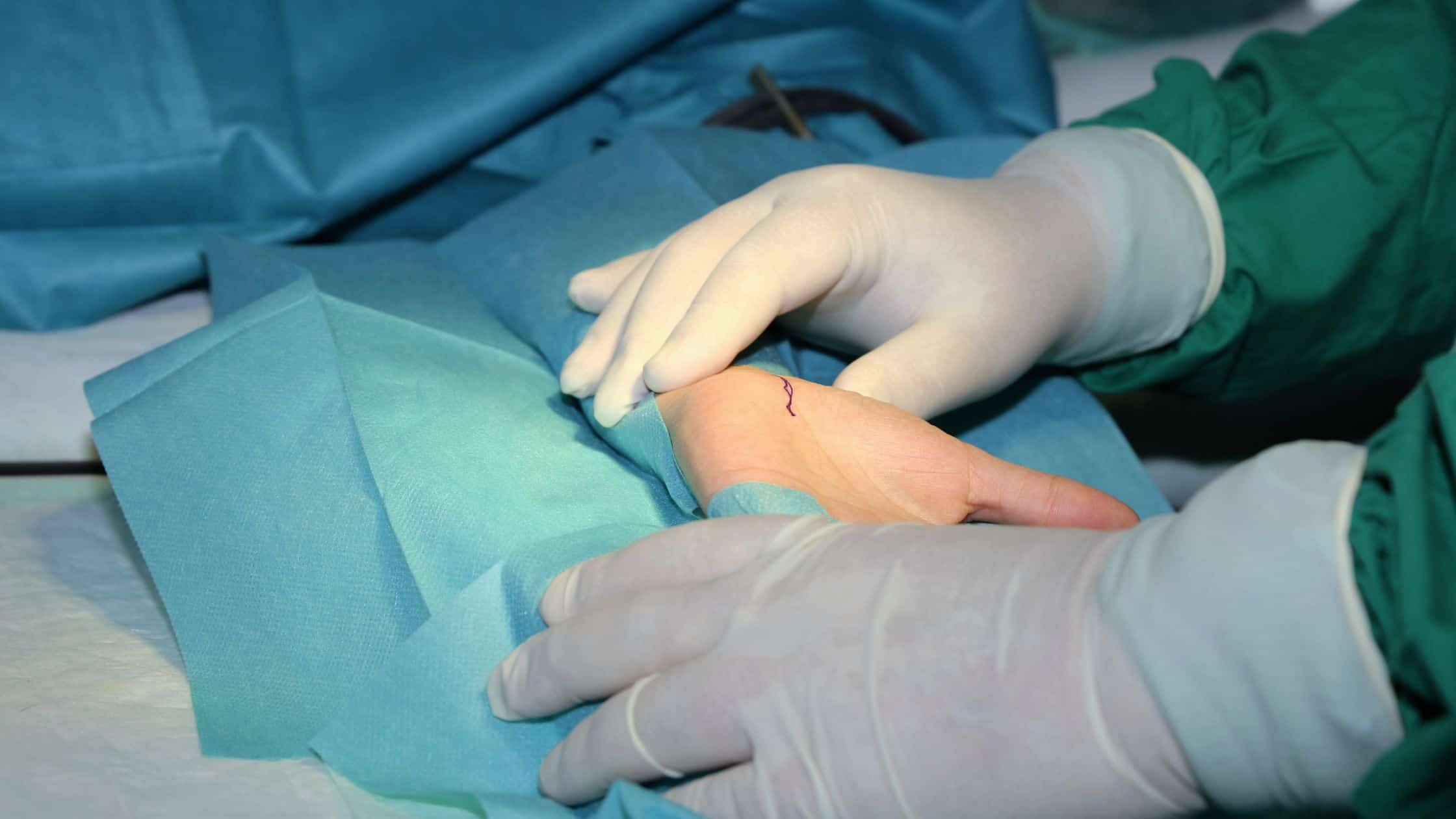 surgery of carpal tunnel 